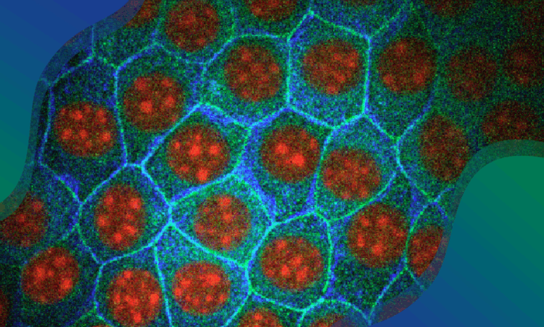 Spatial Transcriptomics Portal: Seeing gene expression in a spatial ...