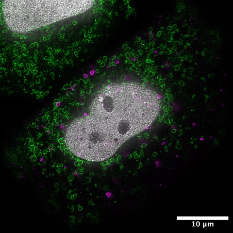 Super-resolution STED microscopy image of a human cell with three NovoTag-labeled structures: magenta puncta marking endosomes, a green branching network of mitochondria, and white-labeled chromatin showing the nucleus's textured DNA pattern, all overlaid on a dark background.