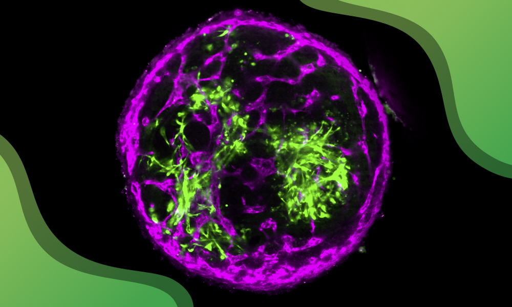 A microscopy image of 3D bovine tissue containing muscle fibers and blood vessel-like networks, shown in bright green and magenta against a black background